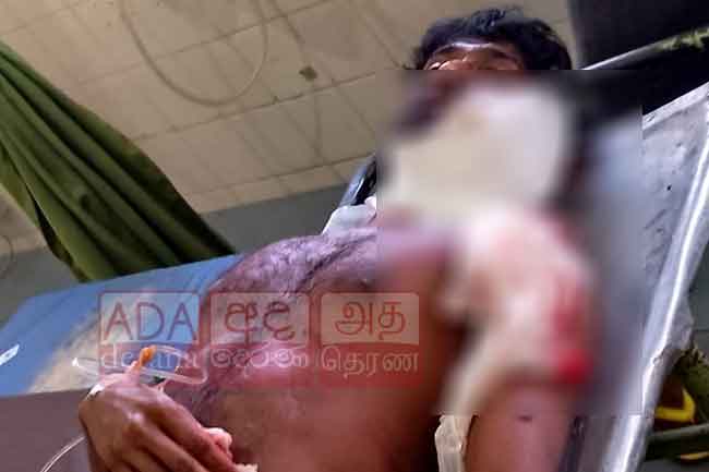 කටුනායක වෙඩිතැබීම ගැන තවත් තොරතුරු